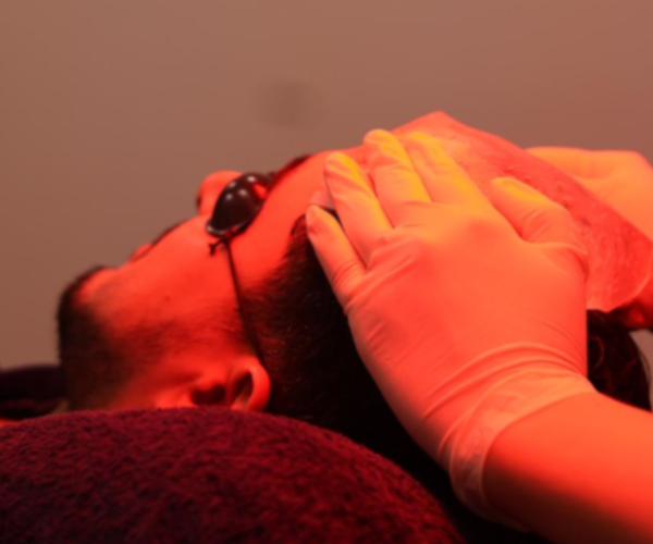 Laser de Baja Frecuencia